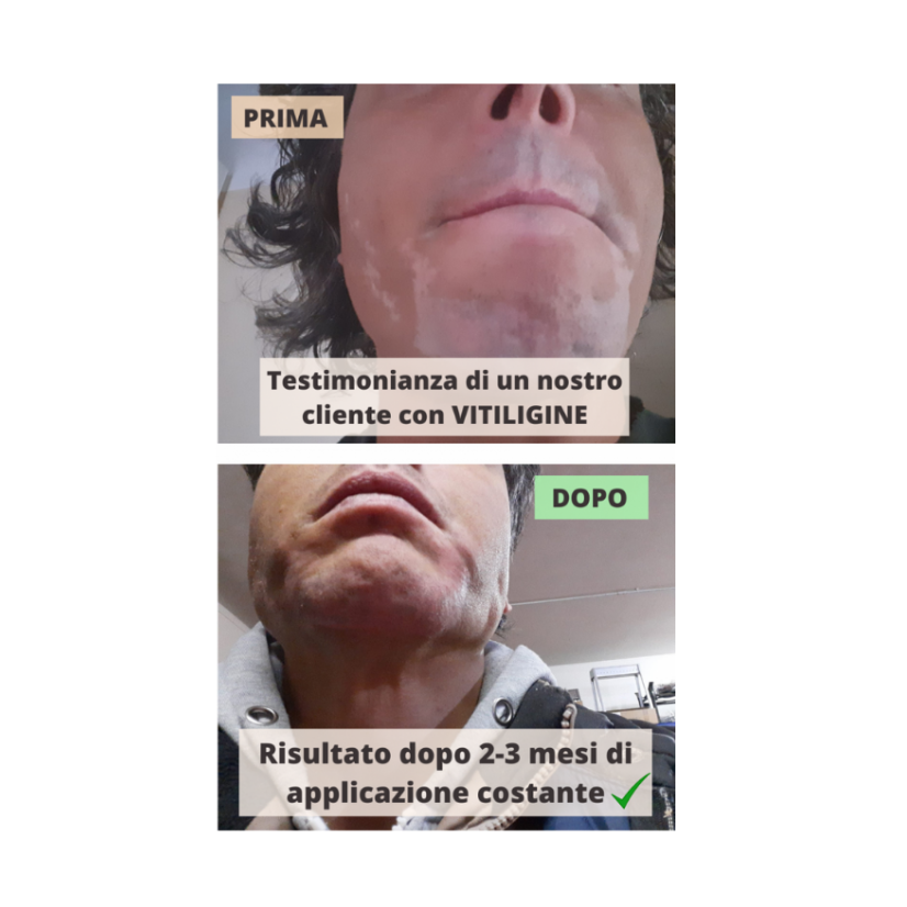 MARS – LAMPADA UV – LAMPADA UV – ELIOSLAMP